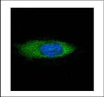 STCH Polyclonal Antibody