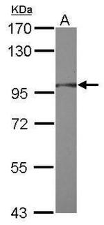 RNF31 Antibody in Western Blot (WB)