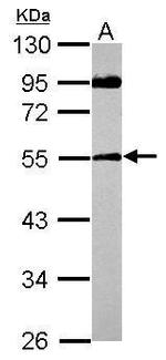 SPAG8 Polyclonal Antibody