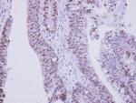 ZNF329 Antibody in Immunohistochemistry (Paraffin) (IHC (P))