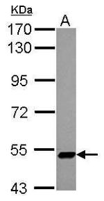 ZNF329 Antibody in Western Blot (WB)