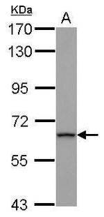 ZNF416 Polyclonal Antibody