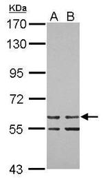 ZNF419 Polyclonal Antibody