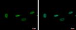 ZNF419 Polyclonal Antibody