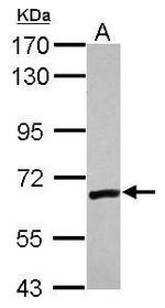 ZNF419 Antibody in Western Blot (WB)