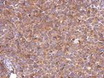 SLC25A46 Polyclonal Antibody
