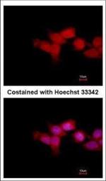 OTUD6B Polyclonal Antibody