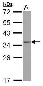 OTUD6B Antibody in Western Blot (WB)