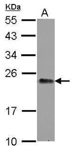 GNPNAT1 Polyclonal Antibody