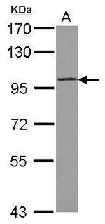 ST18 Polyclonal Antibody