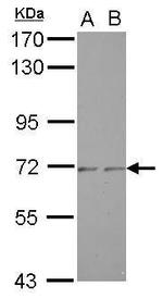 ZNF248 Polyclonal Antibody