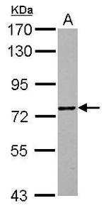 ZNF418 Antibody in Western Blot (WB)