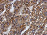 SFXN1 Polyclonal Antibody