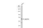 GALNT14 Antibody in Western Blot (WB)
