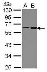 FRMD8 Antibody in Western Blot (WB)