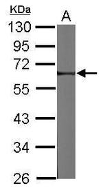FRMD8 Antibody in Western Blot (WB)