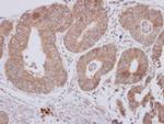 CPEB1 Polyclonal Antibody