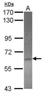 ACOT12 Polyclonal Antibody