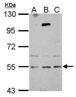 ZNF513 Polyclonal Antibody