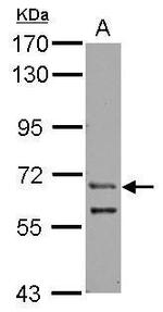 ZFY Polyclonal Antibody