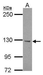 BTBD7 Polyclonal Antibody
