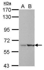 LRWD1 Polyclonal Antibody