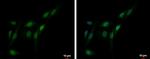 PFKFB3 Antibody in Immunocytochemistry (ICC/IF)