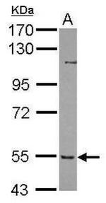 PFKFB3 Antibody in Western Blot (WB)