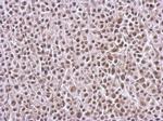 BRMS1L Antibody in Immunohistochemistry (Paraffin) (IHC (P))