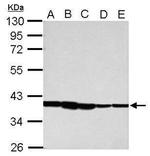 ATXN7L3 Antibody in Western Blot (WB)
