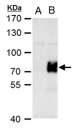 ARID5A Antibody in Western Blot (WB)