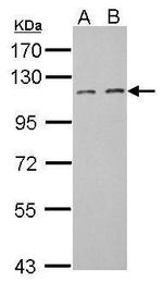 FILIP1L Antibody in Western Blot (WB)