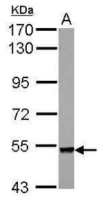 PLXNA4 Polyclonal Antibody