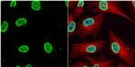 H3K9acK14ac Antibody in Immunocytochemistry (ICC/IF)