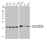 H3K9acK14ac Antibody in Western Blot (WB)