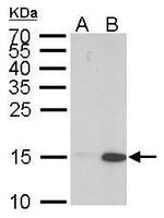 H3K9acK14ac Antibody in Western Blot (WB)