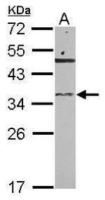 RNASET2 Polyclonal Antibody