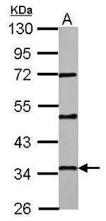 PAQR6 Polyclonal Antibody