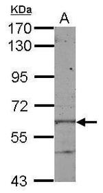 KLHL28 Antibody in Western Blot (WB)