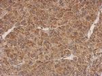 PROSC Polyclonal Antibody