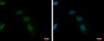 ZFAT Polyclonal Antibody