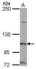 MCM8 Antibody in Western Blot (WB)