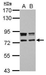 CCDC151 Polyclonal Antibody