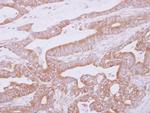 THUMPD2 Antibody in Immunohistochemistry (Paraffin) (IHC (P))