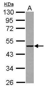 THUMPD2 Antibody in Western Blot (WB)