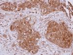 STUB1 Polyclonal Antibody