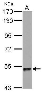 ZNF689 Antibody in Western Blot (WB)