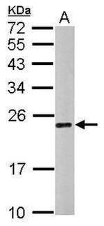CHMP4C Antibody in Western Blot (WB)