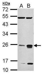 CHMP4C Antibody in Western Blot (WB)