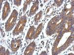 CCDC127 Polyclonal Antibody